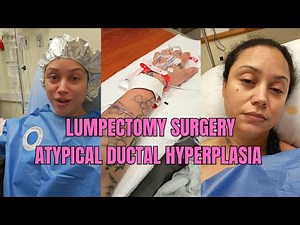 ATYPICAL DUCTAL HYPERPLASIA LUMPECTOMY & DIAGNOSIS #ADH #LUMPECTOMY #MAMMOGRAM #BREASTCANCER #CANCER