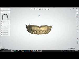 Import files into 3Shape Dental Designer