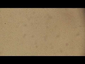 Microscopic Observation of Proteus penneri in Wet Mount Preparation