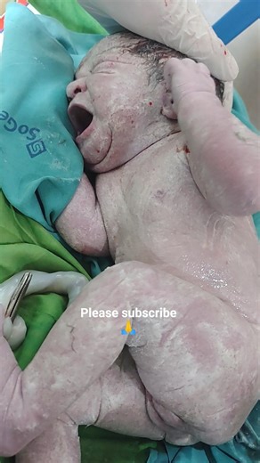 Precious Newborn Baby girl– First Days of Life.#cute #newly #justborn #yt #shorts #trend #viral#care