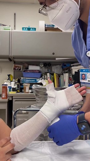 Short Arm Cast Part 1 w/ @joey_t777 #learnontiktok #cast #shortarmcast #orthopaedics