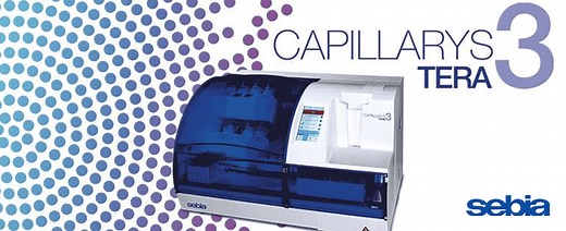 Sebia CAPILLARYS 3 HbA1c - Abacus dx