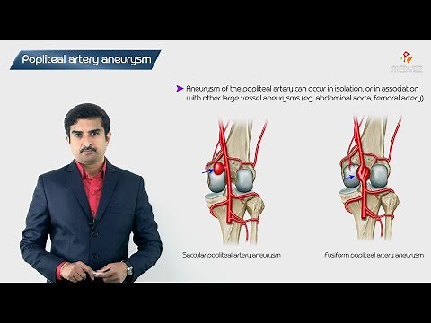 Popliteal Artery Aneurysm | High-Yield Pathology for USMLE Step 1 | Dr G Bhanu Prakash