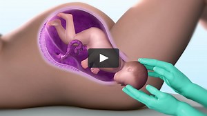 3D Medical Animation - Child Birth Process