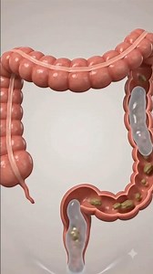 90% Log Isabgol Galat Tarike Se Lete Hain | How to take Isabgol #isabgol #constipation #psylliumhusk