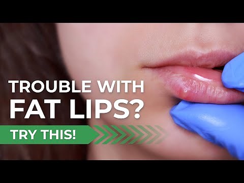 How to Reduce Fat Swollen Lips Naturally at Home