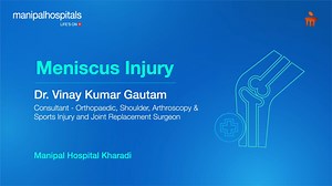 A meniscus injury can impact mobility, cause persistent knee pain, and affect overall joint health. In this informative video, Dr. Vinay Kumar Gautam, Consultant Orthopedic, Shoulder, Arthroscopy & Sports Injury, and Joint Replacement Surgeon at Manipal Hospital Kharadi, explains everything you need to know about meniscus injuries—from common causes to advanced treatment options. Watch now to learn how to protect your knees and explore the latest treatment options for meniscus injuries! For a co