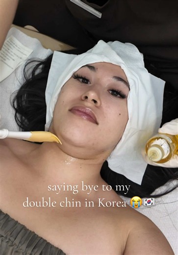 finally saying bye to my double chin🫪😭 in Korea 🇰🇷 @otenaclinic.en | Korean Beauty Treatment