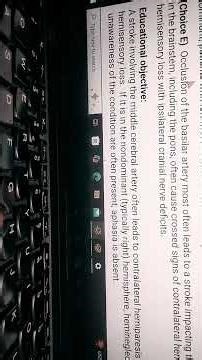 Try to solve UWorld blocks on random tutor mode#uworld #usmle #step1