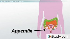Diagnosis of Abdominal Pain: The Four Quadrants