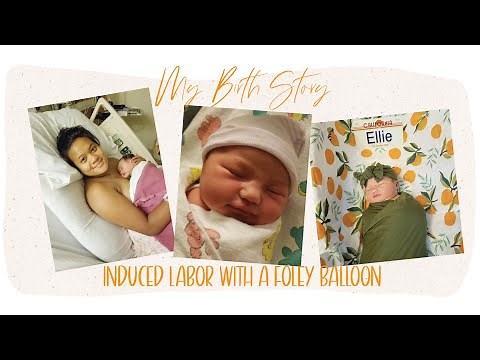 My Birth Story | Foley Balloon Induction
