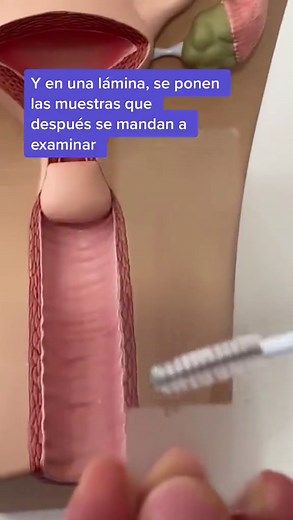 Así se realiza un papanicolau 💜🙌🏼 Les comparto el procedimiento que se realiza al hacer un papanicolau. 🙌🏼💜 Es importante que sepas que debes hacerte papanicolau y colposcopía cada año a partir de que eres activa s3xu4lmente. 😀 ¡Más vale prevenir! #ginecologia #ginecologa #locuentoentiktok #aprendeentiktok #lodescubrientiktok #aquemededico #papanicolau