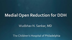 Medial Open Reduction for DDH