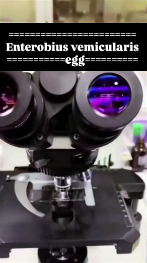 🔬💯Enterobius vermicularis Egg Under Microscope | Pinworm Identification#EnterobiusVermicularis#short