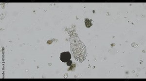 rotifera of the family Habrotrochidae under the microscope - light microscope x200 magnification