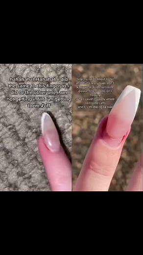 #duet with @helpmynailhurtspls #fyp it comes up the whole way #fingernail #fingernailfallingoff #acrylicsgonewrong
