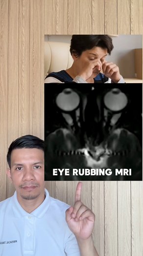 Learn how to rub your eyes gently and see what happens when you rub them vigorously. | Physical Therapy Session