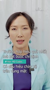 TIÊM FILLER MD CODES ĐƯỢC CHỈ ĐỊNH TRONG TRƯỜNG HỢP NÀO