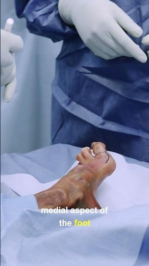 Left First Toe Amputation (Ray, Cadaver) #howto #surgery #medicine #doctor #hospital #learn #watch