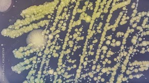 growth of colonies of pathogenic bacteria in laboratory analysis of food quality control. Time lapse of growing microbial and fungal