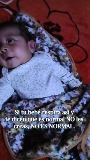 Deficiencia respiratoria en Atrofia Muscular Espinal