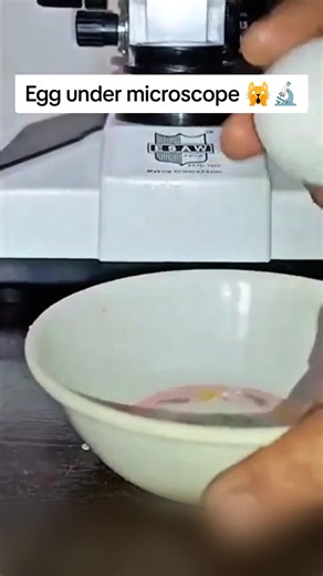 egg under microscope wait watch full video 🙀🔬 #foruyou #fyp #Uk #Usa #unaitedkingdom🇬🇧