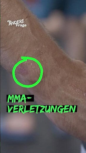 Nikos Verletzungen durch #MMA #funk #wdr