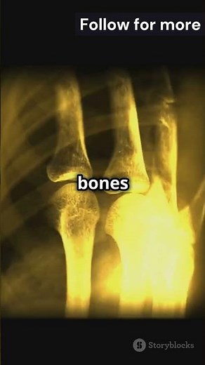 The Man Who Survived Niagara Falls… Twice!!