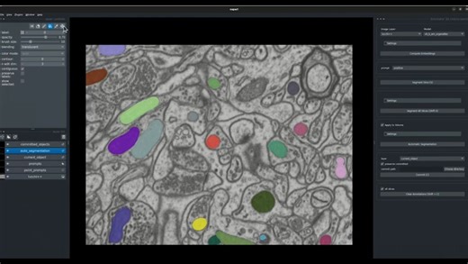 Napari环境下显微镜图像的自动和交互式分割--Segment Anything For Microscopy