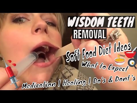 WISDOM TEETH REMOVAL VLOG | WHAT TO EXPECT | FOOD IDEAS