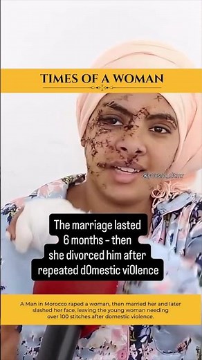 A Man in Morocco raped a woman, then married her and later slashed her face, leaving 100 stitches.