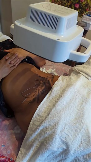 Acupuncture for Beauty: Enhance Your Surgery Results