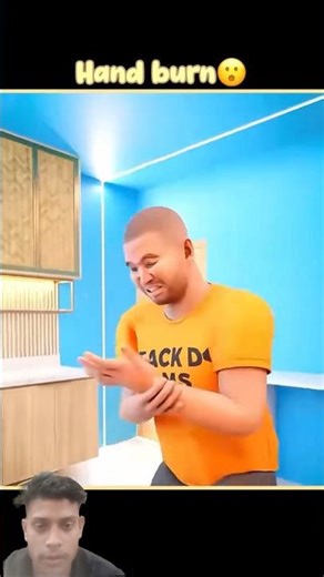 What to do if your hand is burned? 😯❤️‍🔥 #shorts #viralvideo #facts #burn