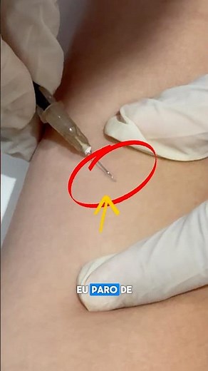 How to administer intradermally during nursing practice.