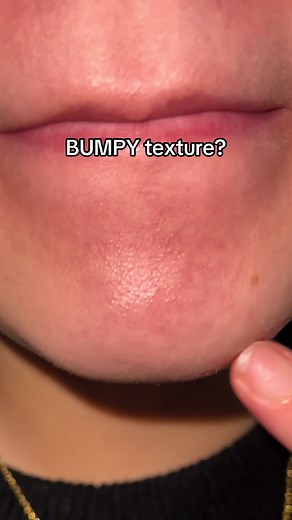 Transform Your Skin with Color-Coded Masks