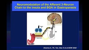 Advances in Neurogastroenterology / Motility for the Clinician