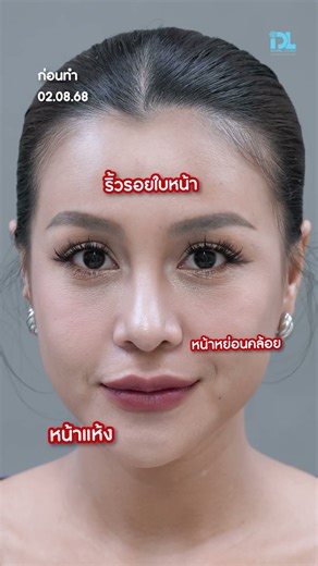 ล็อคหน้าเด็กมีอยู่จริง ด้วย IDL Age Lock Program 😍