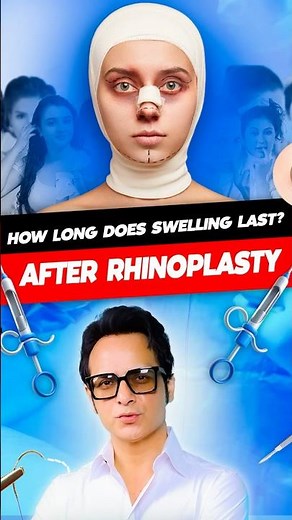 Rhinoplasty Swelling Timeline 🤕 How Long Until Nose Heals? Expert Recovery Guide by Dr. Vikas Gawri