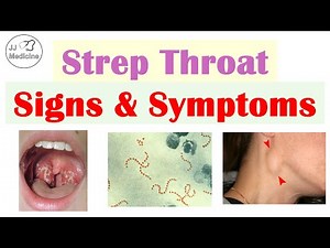 Strep Throat (Streptococcal Pharyngitis) Signs & Symptoms | CENTOR Criteria