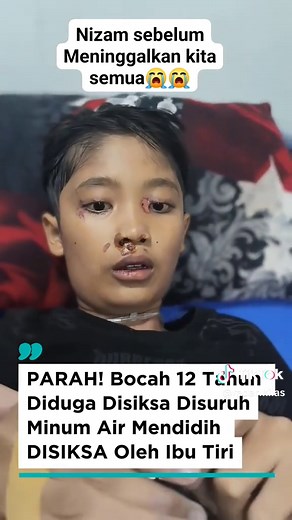😭Bocah 12 tahun di Sukabumi diduga disiksa ibu tiri, bahkan dipaksa minum air panas mendidih 🥲🥲 Kasus ini viral dan keluarga menuntut keadilan. Semoga anak‑anak selalu aman dari kekerasan! 🕊️ #Sukabumi #KekerasanAnak #JusticeForNS #StopChildAbuse #nizam