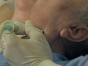 Ultrasound-guided Botulinum Toxin-A Injections: A Method of Treating Sialorrhea