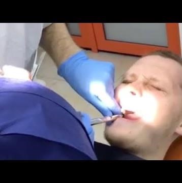 A painful extraction