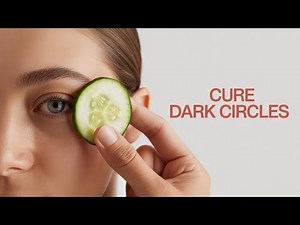 How to Remove Dark Circles Under Eyes Naturally