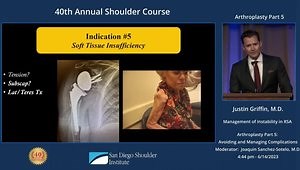 Management of Instability in Reverse Shoulder Arthroplasty