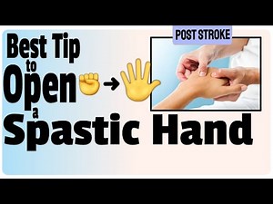 The Best Way to Open Spastic Hands