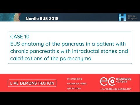 Livedemo | Nordic EUS 2018 | EUS anatomy of the pancreas in a patient with chronic pancreatitis