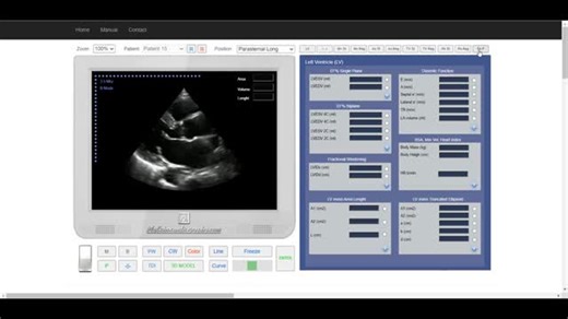MyEchocardiography on Instagram: "PULMONARY ARTERY SYSTOLIC PRESSURE. Read more: https://zurl.co/i5dD"