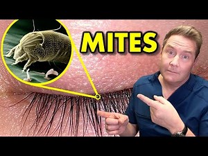 What Are Demodex Mites REALLY Doing To Your Eyelashes And The WRONG Ways To Treat Them.