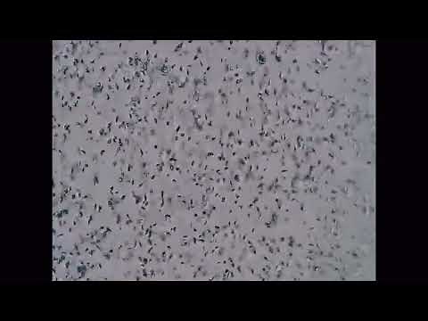 YO Home Sperm Test – Fast & Private Male Fertility Testing