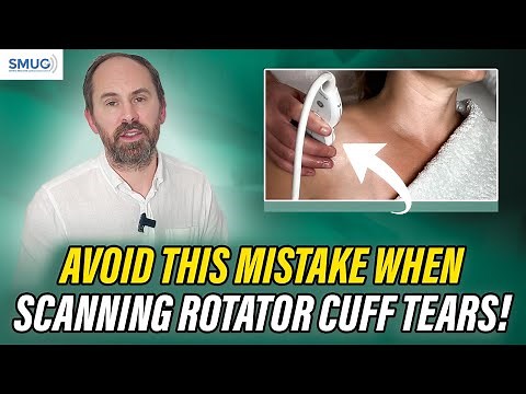 3 Common Mistakes to Avoid When Diagnosing Rotator Cuff Tears on Ultrasound! PART 01